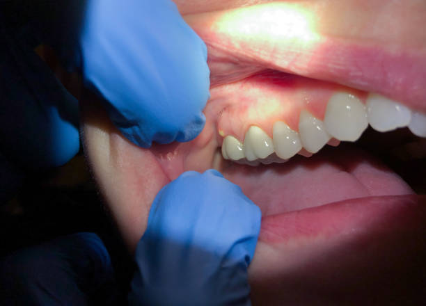 Best Urgent Dental Care  in Cecil Bishop, PA