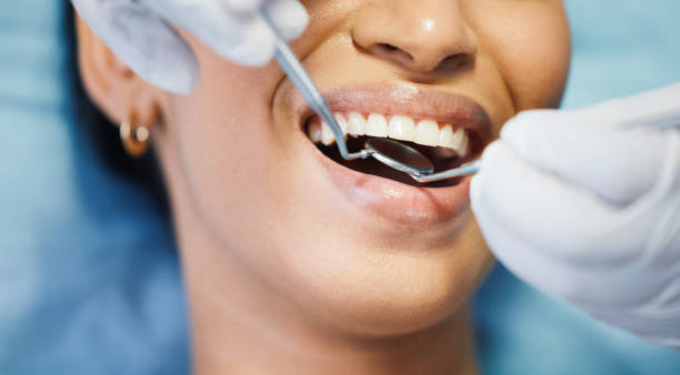 Best Emergency Gum Pain Relief  in Cecil Bishop, PA