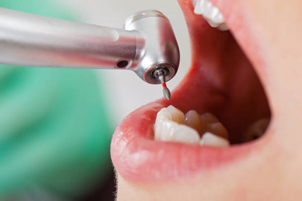 Best Urgent Tooth Repair  in Cecil Bishop, PA
